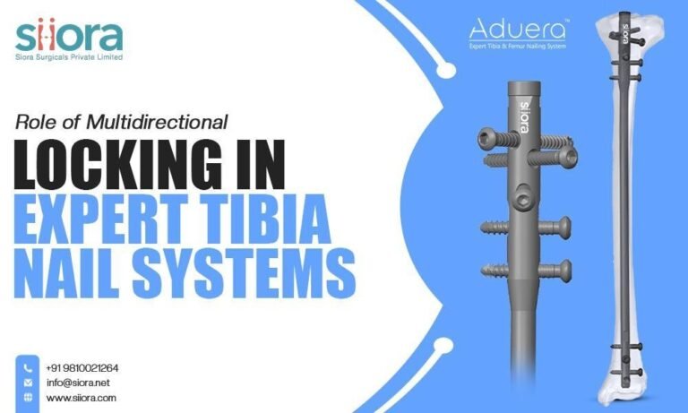 Role of Multidirectional Locking in Expert Tibia Nail Systems